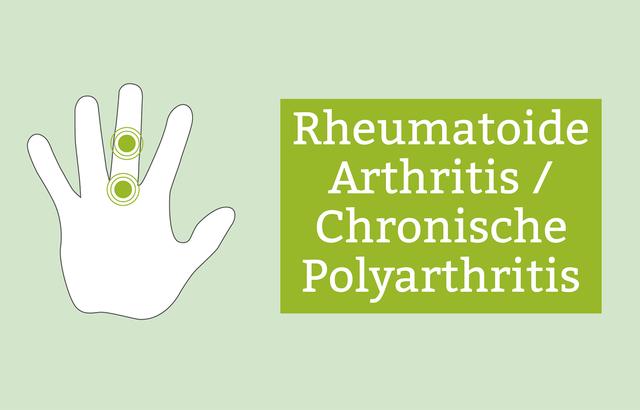 Was Ist Polyarthritis Ursachen Symptome Und Behandlung Von