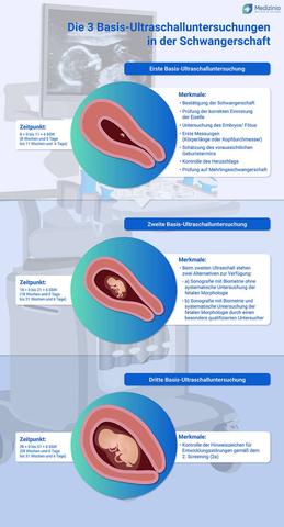 Embryosichtbarkeit im Ultraschall: Welche Woche ist entscheidend? Embryosichtbarkeit im Ultraschall: Welche Woche ist entscheidend?
