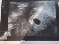 Wann ist der Embryo in der Fruchthöhle sichtbar? Ein Blick auf die Entwicklung Wann ist der Embryo in der Fruchthöhle sichtbar? Ein Blick auf die Entwicklung