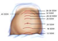 Wann sind die ersten Kindsbewegungen deutlich spürbar? Wann sind die ersten Kindsbewegungen deutlich spürbar?
