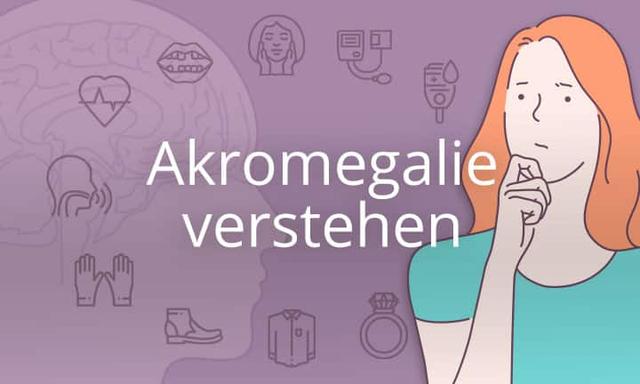 Akren und ihre Vergrößerung bei Akromegalie