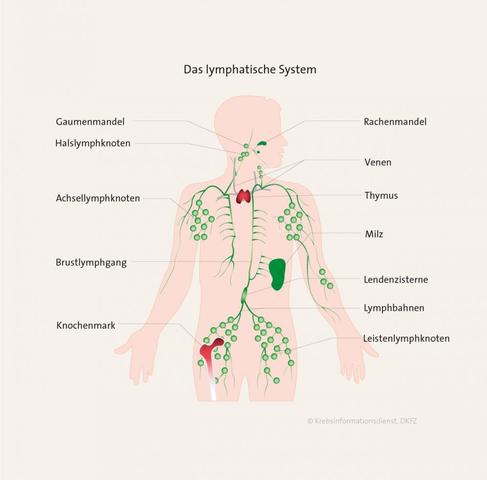 Von Infektion bis Krankheit: Wie sich akzentuierte Lymphknoten manifestieren können Von Infektion bis Krankheit: Wie sich akzentuierte Lymphknoten manifestieren können