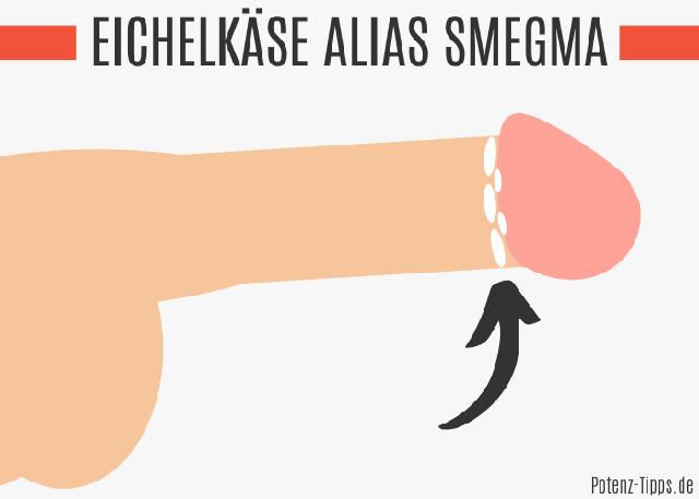 Smegma an Penis und Vagina: Tipps zur Entfernung und Vorbeugung Smegma an Penis und Vagina: Tipps zur Entfernung und Vorbeugung