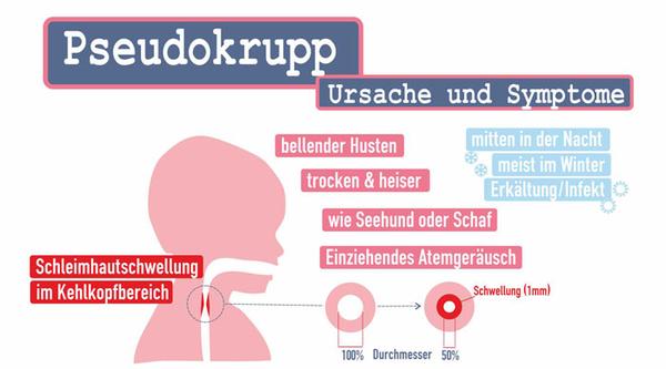 Krupphusten: Bellender Husten und Atemnot bei Kindern Krupphusten: Bellender Husten und Atemnot bei Kindern