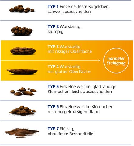 Schwarz gefärbter Stuhl: Was steckt dahinter und wann sollten Sie ärztliche Hilfe suchen?