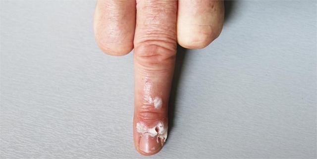 Alles, was du über Smegma wissen musst