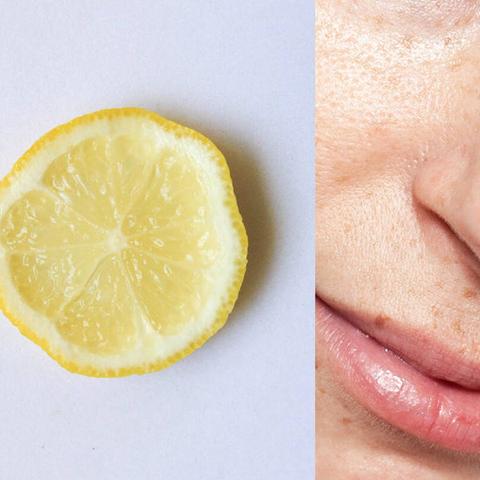 Effektive Hausmittel gegen Altersflecken: Tipps und Tricks Effektive Hausmittel gegen Altersflecken: Tipps und Tricks