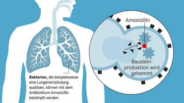 Amoxicillin: Ein Breitband-Antibiotikum zur Behandlung von bakteriellen Infektionen Amoxicillin: Ein Breitband-Antibiotikum zur Behandlung von bakteriellen Infektionen