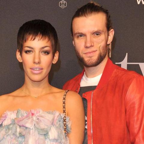 Die Transformation von Andi Weizels Gesicht - Was ist passiert? Die Transformation von Andi Weizels Gesicht - Was ist passiert?