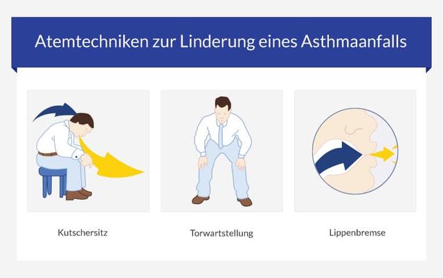 Asthmaanfall ohne Spray Maßnahmen bei akuter Atemnot Sieu Thi Do