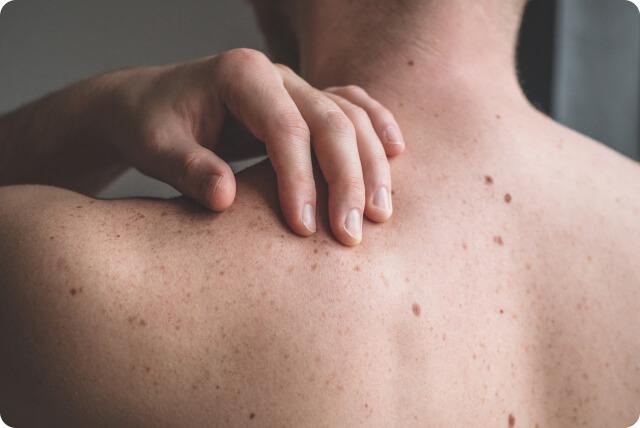 Warum Hausmittel bei der Entfernung von Atheromen nicht helfen Warum Hausmittel bei der Entfernung von Atheromen nicht helfen