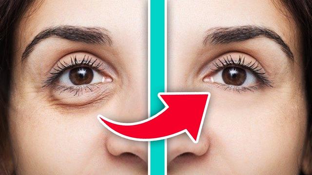 Natürliche Wege, um Augenringe loszuwerden: Hausmittel für ein jugendliches Aussehen Natürliche Wege, um Augenringe loszuwerden: Hausmittel für ein jugendliches Aussehen