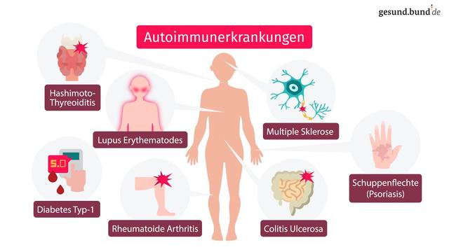 Allgemeinmaßnahmen bei Autoimmunerkrankungen: Tipps für eine angepasste Lebensführung Allgemeinmaßnahmen bei Autoimmunerkrankungen: Tipps für eine angepasste Lebensführung
