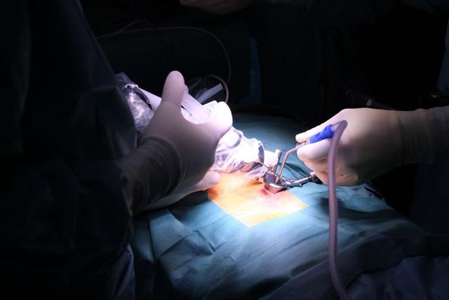 Methoden und Ablauf einer Bandscheiben-Operation im Überblick Methoden und Ablauf einer Bandscheiben-Operation im Überblick
