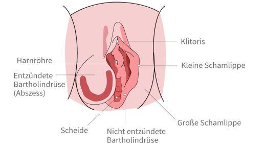 Natürliche Heilung bei Bartholinitis: Was Sie wissen sollten. Natürliche Heilung bei Bartholinitis: Was Sie wissen sollten.