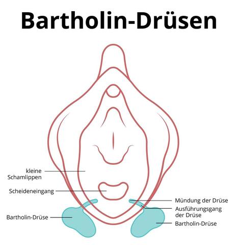 Effektive Selbsthilfe bei Bartholinitis: Hausmittel und Tipps für eine erfolgreiche Behandlung Effektive Selbsthilfe bei Bartholinitis: Hausmittel und Tipps für eine erfolgreiche Behandlung