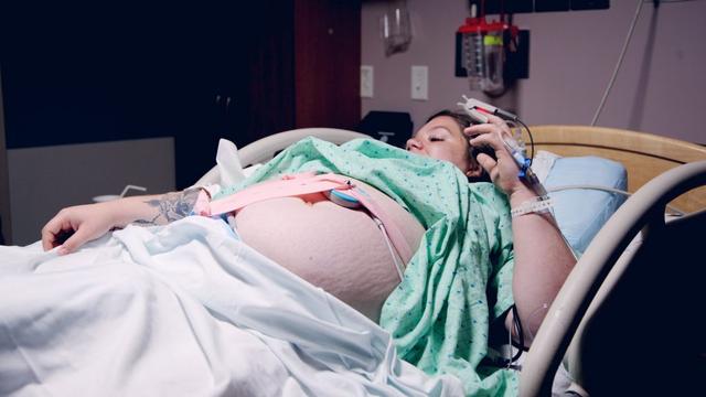 Äußere Wendung bei Beckenendlage: Chancen und Risiken