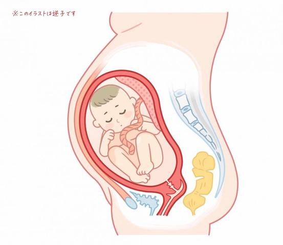 Spezialisten für die Behandlung von Beckenendlage: Empfehlungen und Qualifikationen