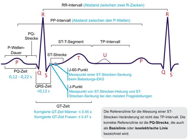 EKG-Auswertung: Verständnis der elektronegativen Komponente EKG-Auswertung: Verständnis der elektronegativen Komponente