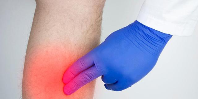 Symptome, Behandlung und Prävention von Venenentzündungen