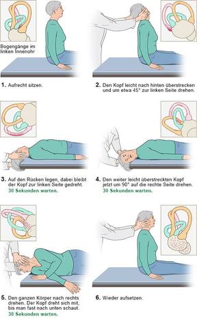 Lagerungsmanöver gegen Lagerungsschwindel: Eine wirksame Lösung Lagerungsmanöver gegen Lagerungsschwindel: Eine wirksame Lösung