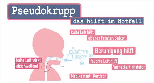 Wie man Krupphusten behandelt: Maßnahmen und Vorbeugung Wie man Krupphusten behandelt: Maßnahmen und Vorbeugung