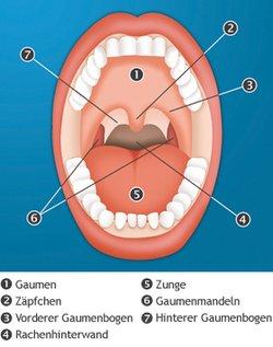 Tonsillektomie oder Tonsillotomie? Wann eine operative Entfernung der Gaumenmandeln sinnvoll ist Tonsillektomie oder Tonsillotomie? Wann eine operative Entfernung der Gaumenmandeln sinnvoll ist