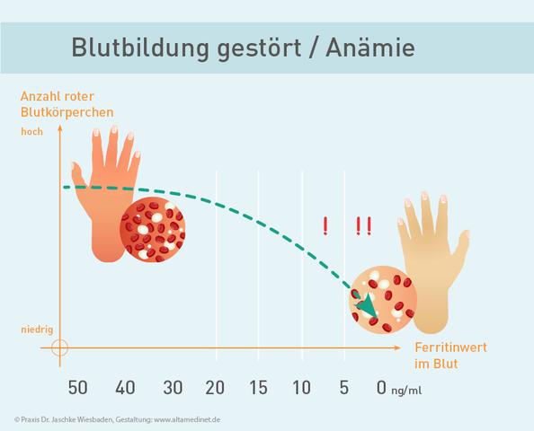 Eisenüberladung im Körper? So senken Sie Ihren Ferritinspiegel effektiv