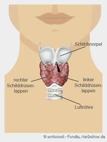 Medikamente, Operation oder Radiojodtherapie: Welche Behandlungsoptionen gibt es bei Schilddrüsenüberfunktion? Medikamente, Operation oder Radiojodtherapie: Welche Behandlungsoptionen gibt es bei Schilddrüsenüberfunktion?