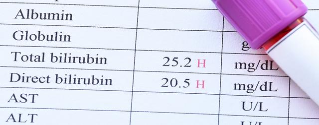Risiken eines hohen Bilirubinwertes bei Erwachsenen: Ab welchem Punkt besteht Gefahr? Risiken eines hohen Bilirubinwertes bei Erwachsenen: Ab welchem Punkt besteht Gefahr?