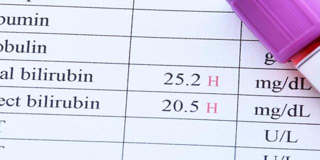 Wann wird ein erhöhter Bilirubinspiegel bei Erwachsenen bedenklich? Wann wird ein erhöhter Bilirubinspiegel bei Erwachsenen bedenklich?