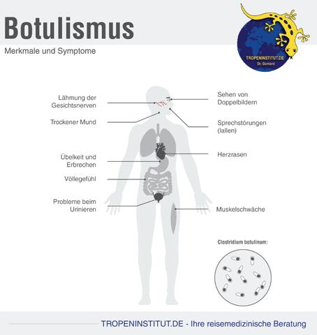 Ursachen und Symptome von Botulismus: Was Sie wissen sollten Ursachen und Symptome von Botulismus: Was Sie wissen sollten