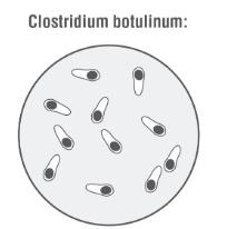 Botulismus: Eine seltene, aber lebensbedrohliche Vergiftung Botulismus: Eine seltene, aber lebensbedrohliche Vergiftung