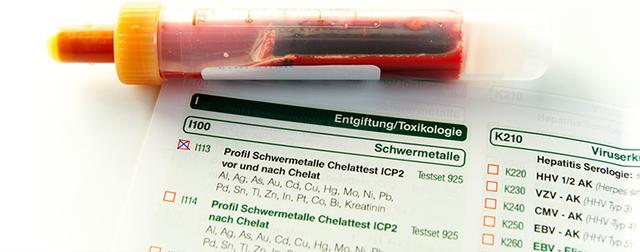 Schwermetallbelastung reduzieren: Die Vorteile der selbstgemachten Chelattherapie Schwermetallbelastung reduzieren: Die Vorteile der selbstgemachten Chelattherapie