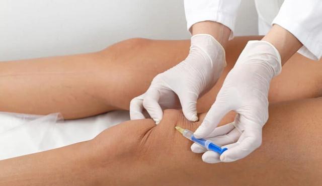 Vergleich von Cortison und MTX: Welches Medikament hat schwerwiegendere Auswirkungen? Vergleich von Cortison und MTX: Welches Medikament hat schwerwiegendere Auswirkungen?