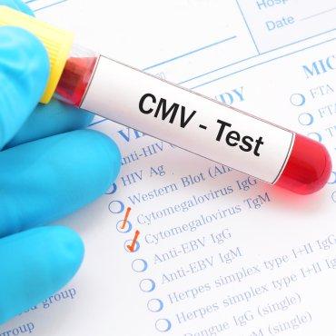 Cytomegalie: Eine Infektionserkrankung mit schwerwiegenden Folgen Cytomegalie: Eine Infektionserkrankung mit schwerwiegenden Folgen