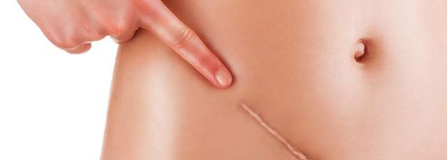 Vorbeugung von Darmverschlüssen: Tipps für eine gesunde Verdauung Vorbeugung von Darmverschlüssen: Tipps für eine gesunde Verdauung