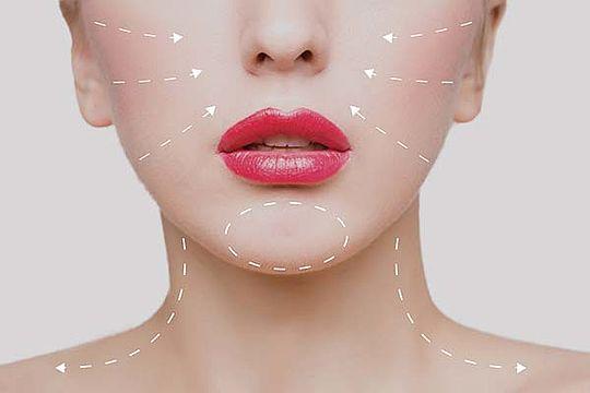 Wie funktioniert das Fadenlifting? Die Geheimnisse einer effektiven Hautstraffung Wie funktioniert das Fadenlifting? Die Geheimnisse einer effektiven Hautstraffung