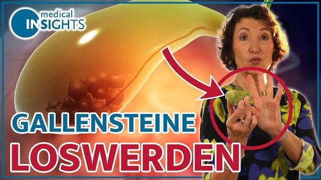 Wiederherstellung nach einer Gallenoperation: Zeitlicher Rahmen und wichtige Informationen Wiederherstellung nach einer Gallenoperation: Zeitlicher Rahmen und wichtige Informationen