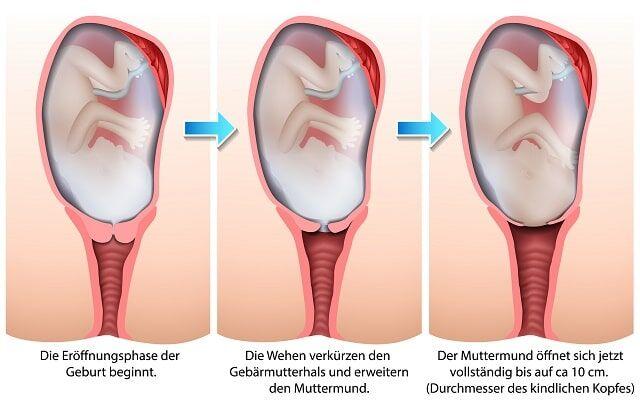 Der Muttermund: Wie fühlt er sich an, wenn er geöffnet ist? Der Muttermund: Wie fühlt er sich an, wenn er geöffnet ist?