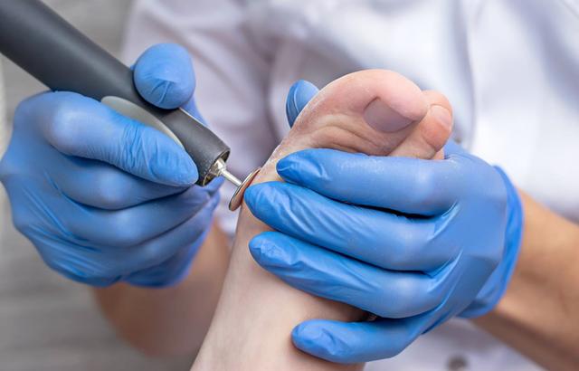 Warum ist eine podologische Behandlung wichtig für Menschen mit Diabetes? Warum ist eine podologische Behandlung wichtig für Menschen mit Diabetes?