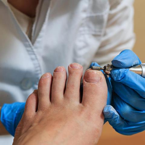 Kostenübernahme durch die Krankenkasse: Wann zahlt sie eine podologische Behandlung? Kostenübernahme durch die Krankenkasse: Wann zahlt sie eine podologische Behandlung?