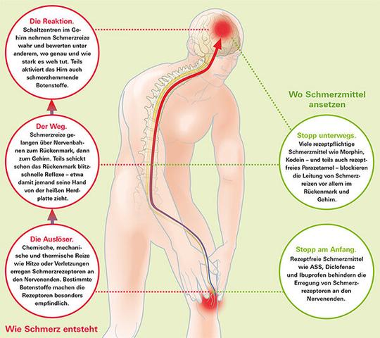 Das beste Schmerzmittel bei starken Schmerzen: Eine Analyse der effektivsten Optionen für akute Beschwerden Das beste Schmerzmittel bei starken Schmerzen: Eine Analyse der effektivsten Optionen für akute Beschwerden