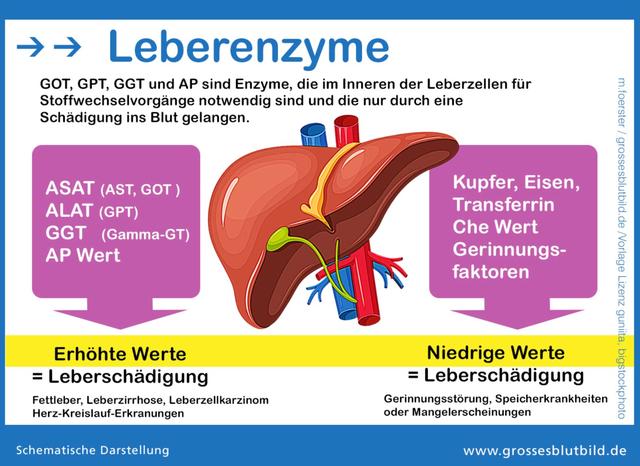 Verstehen Sie die Bedeutung erhöhter Transaminasen im Blut Verstehen Sie die Bedeutung erhöhter Transaminasen im Blut
