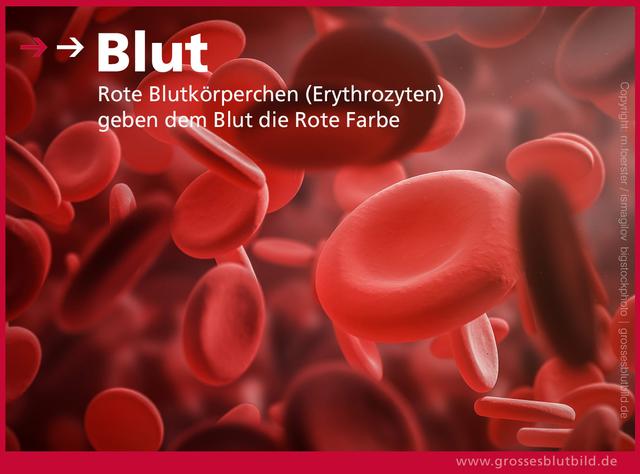 MCV-Wert und Anämie: Differentialdiagnostische Parameter erklärt MCV-Wert und Anämie: Differentialdiagnostische Parameter erklärt