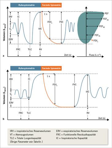 Warum ist eine Lungenfunktion von 70 Prozent wichtig?
