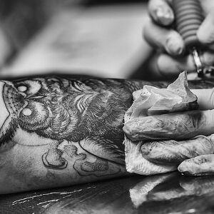 6. Effektive und schonende Tattooentfernung: Experten aus dem tattoolos-Netzwerk helfen weiter
