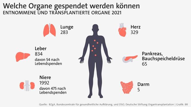 Transplantation: Verpflanzung von Organen und Geweben für ein besseres Leben Transplantation: Verpflanzung von Organen und Geweben für ein besseres Leben