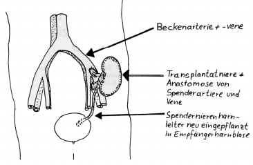 Transplantationen als medizinischer Standard: Verbesserte Lebenserwartung und -qualität Transplantationen als medizinischer Standard: Verbesserte Lebenserwartung und -qualität
