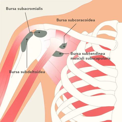 Die besten Übungen und Tipps zur Selbstbehandlung bei Schleimbeutelentzündung in der Schulter Die besten Übungen und Tipps zur Selbstbehandlung bei Schleimbeutelentzündung in der Schulter